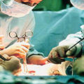 البواسير و جراحات الامساك المزمن عند الأطفال
